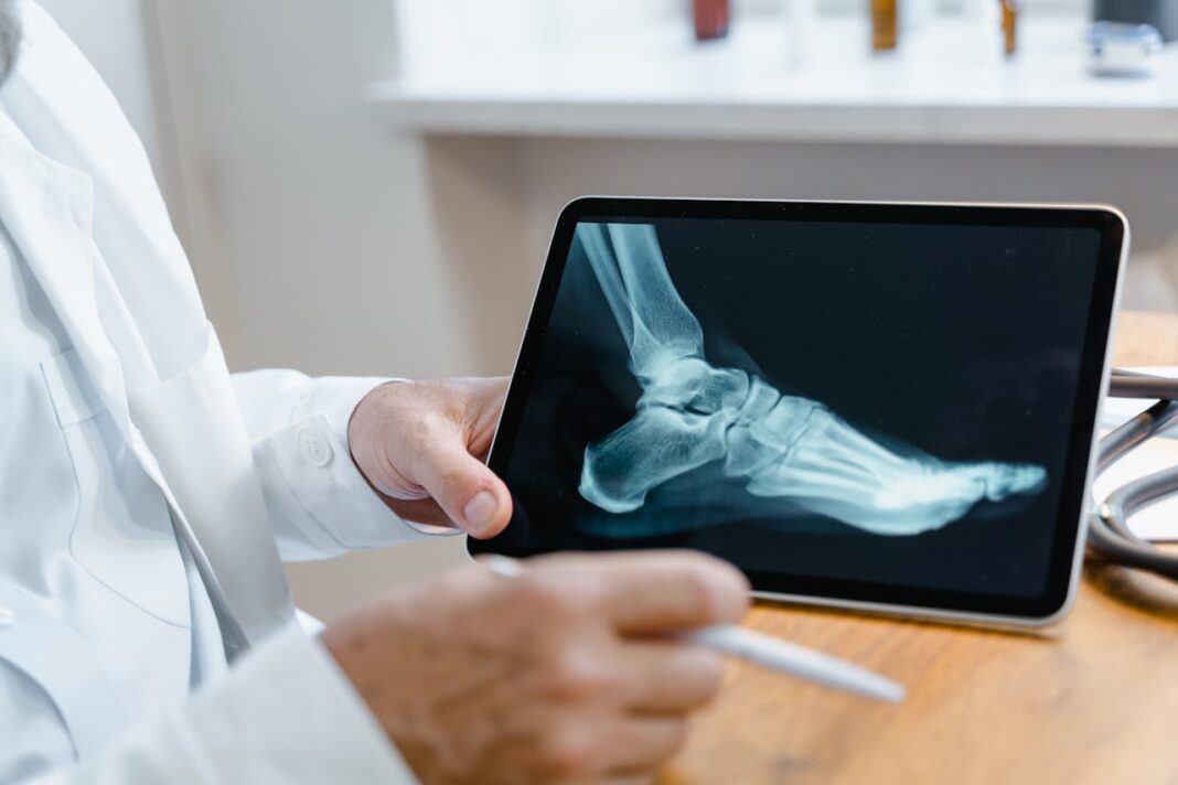 A person in a white coat and holding a pen, holds up a tablet computer with an x-ray of a foot showing on its screen.